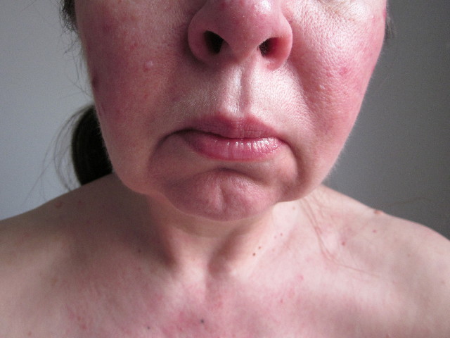 lower face.jpg