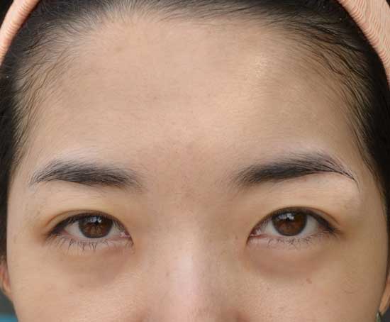 Me in natural light, no makeup.