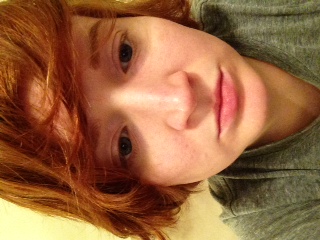 skin pic